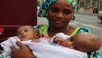 Des Bebes Siamois Guineens Separes Avec Succes A Paris Jeune Afrique